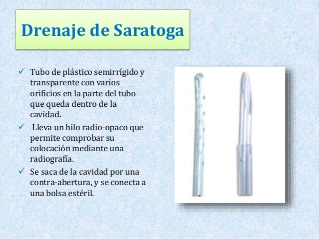 drenaje de saratoga